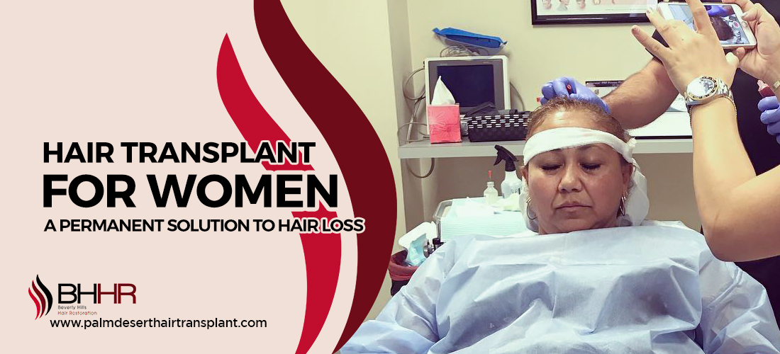 Hair Transplant For Women