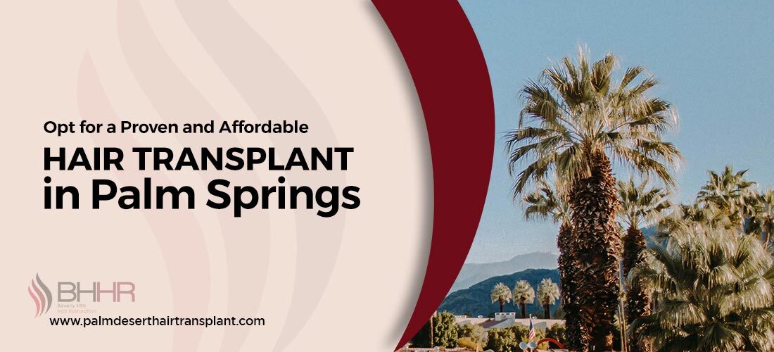 Hair transplant Palm Springs