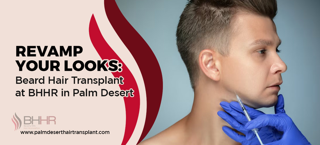 Beard Hair Transplant at Los Angeles