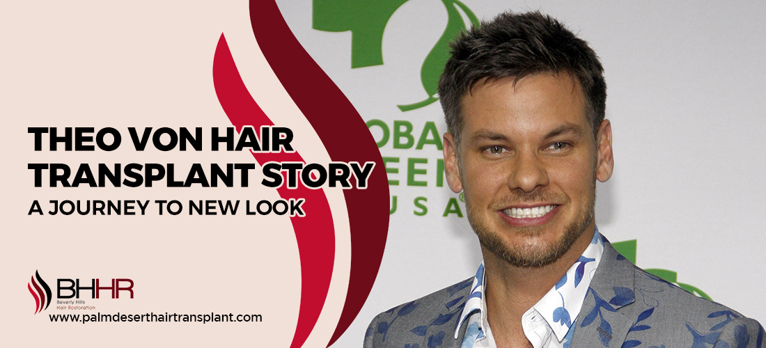 Theo Von hair transplant